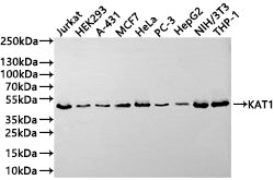 Western Blot
Positive WB detected in: Jurkat whole cell lysate(30µg) , HEK293 whole cell lysate(30µg) , A-431 whole cell lysate(30µg) , MCF-7 whole cell lysate(30µg) , HeLa whole cell lysate(30µg) , PC-3 whole cell lysate(30µg) , HepG2 whole cell lysate(30µg) , NIH/3T3 whole cell lysate(30µg) , THP-1 whole cell lysate(30µg) 
All lanes: KAT1 antibody at 1:1000
Secondary
Goat polyclonal to rabbit IgG at 1/50000 dilution
Predicted band size: 50 kDa
Observed band size: 50 kDa
Exposure time: 3min
