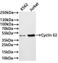 Western Blot
Positive WB detected in: K562 whole cell lysate(30µg) , Jurkat whole cell lysate(30µg) 
All lanes:Cyclin E2 antibody at 1:1000
Secondary
Goat polyclonal to rabbit IgG at 1/40000 dilution
Predicted band size: 47 kDa
Observed band size: 47 kDa
Exposure time：2min40s