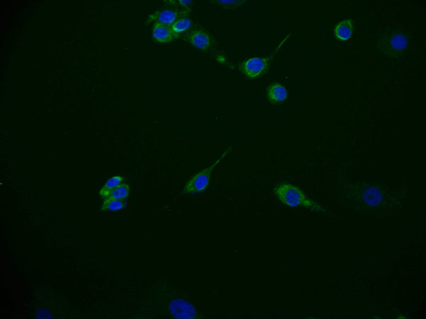 Immunofluorescence staining of MCF-7 cell with CSB-RA172768A0HU at 1:50, counter-stained with DAPI. The cells were fixed in 4% formaldehyde and blocked in 10% normal Goat Serum. The cells were then incubated with the antibody overnight at 4°C. The secondary antibody was Alexa Fluor 536-congugated AffiniPure Goat Anti-Rabbit IgG(H+L) .