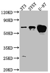 Western Blot
Positive WB detected in: NIH/3T3 whole cell lysate, SH-SY5Y whole cell lysate, U-87 whole cell lysate
All lanes: Estrogen Receptor alpha antibody at 1:1000
Secondary
Goat polyclonal to rabbit IgG at 1/50000 dilution
Predicted band size: 67, 54, 48, 36 kDa
Observed band size: 67 kDa