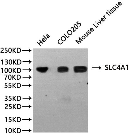 Western Blot, 
Positive WB detected in: Hela whole cell lysate(30µg), COLO205 whole cell lysate(30µg), Mouse liver tissue lysate(30µg)
All lanes: SLC4A1 antibody at 1:1000
Secondary
Goat polyclonal to rabbit IgG at 1/40000 dilution
Predicted band size: 102 kDa
Observed band size: 102 kDa
Exposure time：120s