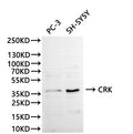 Western Blot, 
Positive WB detected in:PC-3 whole cell lysate(30µg), SH-SY5Y whole cell lysate(30µg)
All lanes: CRK antibody at 1:1000
Secondary
Goat polyclonal to rabbit IgG at 1/40000 dilution
Predicted band size: 34 kDa
Observed band size: 38 kDa
Exposure time：120s