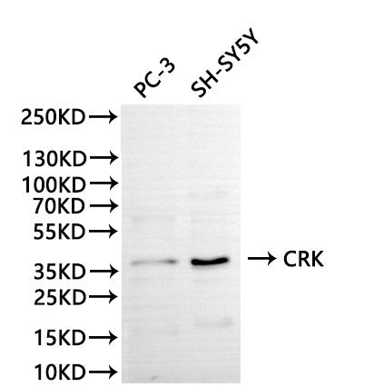 Western Blot, 
Positive WB detected in:PC-3 whole cell lysate(30µg), SH-SY5Y whole cell lysate(30µg)
All lanes: CRK antibody at 1:1000
Secondary
Goat polyclonal to rabbit IgG at 1/40000 dilution
Predicted band size: 34 kDa
Observed band size: 38 kDa
Exposure time：120s