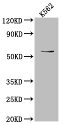 Western Blot
Positive WB detected in: K562 whole cell lysate
All lanes: UAP1 antibody at 1:1000
Secondary
Goat polyclonal to rabbit IgG at 1/50000 dilution
Predicted band size: 59, 58, 59 kDa
Observed band size: 59 kDa