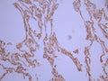 IHC image of CSB-RA174440A0HU diluted at 1:100 and staining in paraffin-embedded human lung tissue performed on a Leica BondTM system. After dewaxing and hydration, antigen retrieval was mediated by high pressure in a citrate buffer (pH 6.0). Section was blocked with 10% normal goat serum 30min at RT. Then primary antibody (1% BSA) was incubated at 4°C overnight. The primary is detected by a Goat anti-rabbit polymer IgG labeled by HRP and visualized using 0.05% DAB.