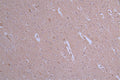 IHC image of CSB-RA175460A0HU diluted at 1:50 and staining in paraffin-embedded human brain tissue performed on a Leica BondTM system. After dewaxing and hydration, antigen retrieval was mediated by high pressure in a citrate buffer (pH 6.0) . Section was blocked with 10% normal goat serum 30min at RT. Then primary antibody (1% BSA) was incubated at 4°C overnight. The primary is detected by a Goat anti-rabbit polymer IgG labeled by HRP and visualized using 0.19% DAB.