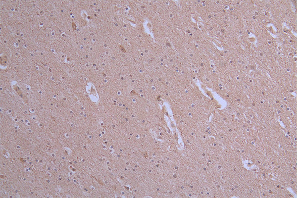 IHC image of CSB-RA175460A0HU diluted at 1:50 and staining in paraffin-embedded human brain tissue performed on a Leica BondTM system. After dewaxing and hydration, antigen retrieval was mediated by high pressure in a citrate buffer (pH 6.0) . Section was blocked with 10% normal goat serum 30min at RT. Then primary antibody (1% BSA) was incubated at 4°C overnight. The primary is detected by a Goat anti-rabbit polymer IgG labeled by HRP and visualized using 0.19% DAB.