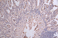 KRT20 Recombinant Monoclonal Antibody – Figure 1 of 2