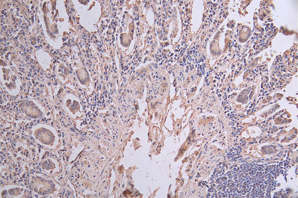 KRT20 Recombinant Monoclonal Antibody – Figure 1 of 2