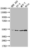 Western Blot
Positive WB detected in: HEK293 whole cell lysate, PC-3 whole cell lysate, MCF-7 whole cell lysate, Hela whole cell lysate
All lanes: AHCY antibody at 1:2000
Secondary
Goat polyclonal to rabbit IgG at 1/50000 dilution
Predicted band size: 48, 45 kDa
Observed band size: 36-55 kDa