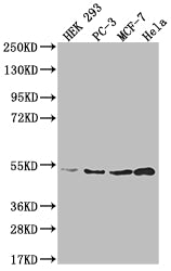 Western Blot
Positive WB detected in: HEK293 whole cell lysate, PC-3 whole cell lysate, MCF-7 whole cell lysate, Hela whole cell lysate
All lanes: AHCY antibody at 1:2000
Secondary
Goat polyclonal to rabbit IgG at 1/50000 dilution
Predicted band size: 48, 45 kDa
Observed band size: 36-55 kDa