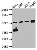 CHEK1 Antibody – Figure 1 of 3