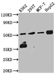 CHEK1 Antibody – Figure 1 of 3