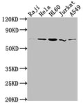 Western Blot
Positive WB detected in: Raji whole cell lysate, Hela whole cell lysate, HL60 whole cell lysate, Jurkat whole cell lysate, A549 whole cell lysate
All lanes: PRMT5 antibody at 1:2000
Secondary
Goat polyclonal to rabbit IgG at 1/50000 dilution
Predicted band size: 73, 72, 54, 68, 67 kDa
Observed band size: 73 kDa