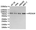 Western Blot
Positive WB detected in: HT-29 whole cell lysate(30µg), Hela whole cell lysate(30µg), HEK293 whole cell lysate(30µg), MCF-7 whole cell lysate(30µg)
All lanes: PICALM antibody at 1:1000
Secondary
Goat polyclonal to rabbit IgG at 1/40000 dilution
Predicted band size: 71 kDa
Observed band size: 69&71 kDa
Exposure time：20s