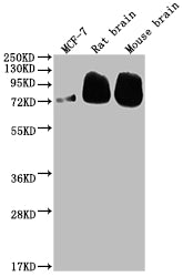 Western Blot
Positive WB detected in: MCF-7 whole cell lysate, Rat brain tissue, Mouse brain tissue
All lanes: BACE1 antibody at 1:2000
Secondary
Goat polyclonal to rabbit IgG at 1/50000 dilution
Predicted band size: 56, 53, 52, 49, 46, 43 kDa
Observed band size: 72 kDa