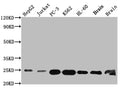 Western Blot
Positive WB detected in: HepG2 whole cell lysate, Jurkat whole cell lysate, PC-3 whole cell lysate, K562 whole cell lysate, HL-60 whole cell lysate, Mouse Brain whole cell lysate, Rat Brain whole cell lysate
All lanes: GSTP1 antibody at 1:1000
Secondary
Goat polyclonal to rabbit IgG at 1/50000 dilution
Predicted band size: 24 kDa
Observed band size: 24 kDa
