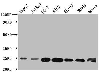 Western Blot
Positive WB detected in: HepG2 whole cell lysate, Jurkat whole cell lysate, PC-3 whole cell lysate, K562 whole cell lysate, HL-60 whole cell lysate, Mouse Brain whole cell lysate, Rat Brain whole cell lysate
All lanes: GSTP1 antibody at 1:1000
Secondary
Goat polyclonal to rabbit IgG at 1/50000 dilution
Predicted band size: 24 kDa
Observed band size: 24 kDa
