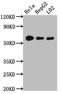 Western Blot
Positive WB detected in: Hela whole cell lysate, HepG2 whole cell lysate, L02 whole cell lysate
All lanes: CYP1A2 antibody at 1:1000
Secondary
Goat polyclonal to rabbit IgG at 1/50000 dilution
Predicted band size: 59 kDa
Observed band size: 59 kDa