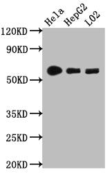 Western Blot
Positive WB detected in: Hela whole cell lysate, HepG2 whole cell lysate, L02 whole cell lysate
All lanes: CYP1A2 antibody at 1:1000
Secondary
Goat polyclonal to rabbit IgG at 1/50000 dilution
Predicted band size: 59 kDa
Observed band size: 59 kDa