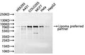 Western Blot, 
Positive WB detected in:HEK293 whole cell lysate(30µg), A431 whole cell lysate(30µg), COLO205 whole cell lysate(30µg), MCF7 whole cell lysate(30µg), Hela whole cell lysate(30µg), HepG2 whole cell lysate(30µg)
All lanes: Lipoma preferred partner antibody at 1:1000
Secondary
Goat polyclonal to rabbit IgG at 1/40000 dilution
Predicted band size: 66 kDa
Observed band size: 75 kDa
Exposure time：20s