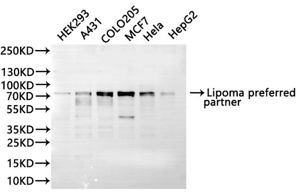 Western Blot, 
Positive WB detected in:HEK293 whole cell lysate(30µg), A431 whole cell lysate(30µg), COLO205 whole cell lysate(30µg), MCF7 whole cell lysate(30µg), Hela whole cell lysate(30µg), HepG2 whole cell lysate(30µg)
All lanes: Lipoma preferred partner antibody at 1:1000
Secondary
Goat polyclonal to rabbit IgG at 1/40000 dilution
Predicted band size: 66 kDa
Observed band size: 75 kDa
Exposure time：20s