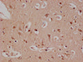 IHC image of CSB-RA179313A0HU diluted at 1:100 and staining in paraffin-embedded human brain tissue performed on a Leica BondTM system. After dewaxing and hydration, antigen retrieval was mediated by high pressure in a citrate buffer (pH 6.0) . Section was blocked with 10% normal goat serum 30min at RT. Then primary antibody (1% BSA) was incubated at 4°C overnight. The primary is detected by a Goat anti-rabbit polymer IgG labeled by HRP and visualized using 0.05% DAB.