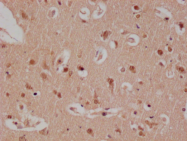 IHC image of CSB-RA179313A0HU diluted at 1:100 and staining in paraffin-embedded human brain tissue performed on a Leica BondTM system. After dewaxing and hydration, antigen retrieval was mediated by high pressure in a citrate buffer (pH 6.0) . Section was blocked with 10% normal goat serum 30min at RT. Then primary antibody (1% BSA) was incubated at 4°C overnight. The primary is detected by a Goat anti-rabbit polymer IgG labeled by HRP and visualized using 0.05% DAB.