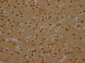 IHC image of CSB-RA180423A0HU diluted at 1:100 and staining in paraffin-embedded human brain tissue performed on a Leica BondTM system. After dewaxing and hydration, antigen retrieval was mediated by high pressure in a citrate buffer (pH 6.0) . Section was blocked with 10% normal goat serum 30min at RT. Then primary antibody (1% BSA) was incubated at 4℃ overnight. The primary is detected by a Goat anti-rabbit IgG polymer labeled by HRP and visualized using 0.05% DAB.
