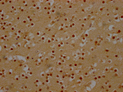 IHC image of CSB-RA180423A0HU diluted at 1:100 and staining in paraffin-embedded human brain tissue performed on a Leica BondTM system. After dewaxing and hydration, antigen retrieval was mediated by high pressure in a citrate buffer (pH 6.0) . Section was blocked with 10% normal goat serum 30min at RT. Then primary antibody (1% BSA) was incubated at 4℃ overnight. The primary is detected by a Goat anti-rabbit IgG polymer labeled by HRP and visualized using 0.05% DAB.
