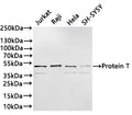 Western Blot
Positive WB detected in: Jurkat whole cell lysate(30µg) ,Raji whole cell lysate(30µg) ,Hela whole cell lysate(30µg) ,SH-SY5Y whole cell lysate(30µg) 
All lanes: Protein T antibody at 1:1000
Secondary
Goat polyclonal to rabbit IgG at 1/40000 dilution
Predicted band size: 47 kDa
Observed band size: 47,41 kDa
Exposure time：3min