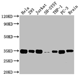 Predicted band size: 37 kDa