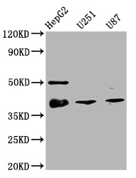 Western Blot
Positive WB detected in: HepG2 whole cell lysate, U251 whole cell lysate, U87 whole cell lysate
All lanes: TTF1 antibody at 1:2000
Secondary
Goat polyclonal to rabbit IgG at 1/50000 dilution
Predicted band size: 39 kDa
Observed band size: 39 kDa