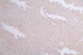IHC image of CSB-RA18201:50A0HU diluted at 1:50 and staining in paraffin-embedded human brain tissue performed on a Leica BondTM system. After dewaxing and hydration, antigen retrieval was mediated by high pressure in a citrate buffer (pH 6.0) . Section was blocked with 10% normal goat serum 30min at RT. Then primary antibody (1% BSA) was incubated at 4°C overnight. The primary is detected by a Goat anti-rabbit polymer IgG labeled by HRP and visualized using 0.60% DAB.