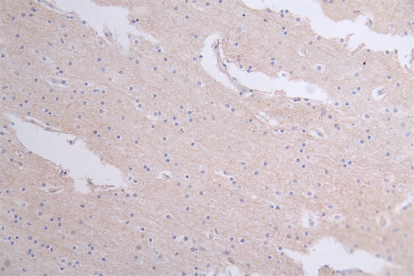 IHC image of CSB-RA18201:50A0HU diluted at 1:50 and staining in paraffin-embedded human brain tissue performed on a Leica BondTM system. After dewaxing and hydration, antigen retrieval was mediated by high pressure in a citrate buffer (pH 6.0) . Section was blocked with 10% normal goat serum 30min at RT. Then primary antibody (1% BSA) was incubated at 4°C overnight. The primary is detected by a Goat anti-rabbit polymer IgG labeled by HRP and visualized using 0.60% DAB.