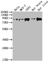 Western Blot
Positive WB detected in: Hela whole cell lysate, MCF-7 whole cell lysate, U251 whole cell lysate, Rat brain tissue, Rat liver tissue
All lanes: VCP antibody at 1:2000
Secondary
Goat polyclonal to rabbit IgG at 1/50000 dilution
Predicted band size: 90 kDa
Observed band size: 90 kDa