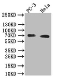 Western Blot
Positive WB detected in: PC-3 whole cell lysate,Hela whole cell lysate
All lanes: Placental alkaline phosphatase (PLAP) antibody at 1:1000
Secondary
Goat polyclonal to rabbit IgG at 1/50000 dilution
Predicted band size: 70 kDa
Observed band size: 70 kDa