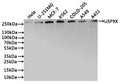 Western Blot
Positive WB detected in: Hela whole cell lysate(30µg), U-251MG whole cell lysate(30µg), MCF-7 whole cell lysate(30µg), K562 whole cell lysate(30µg), COLO-205 whole cell lysate(30µg), A549 whole cell lysate(30µg), A431 whole cell lysate(30µg)
All lanes: USP9X antibody at 1:1000
Secondary
Goat polyclonal to rabbit IgG at 1/40000 dilution
Predicted band size: 290 kDa
Observed band size: 292 kDa
Exposure time：30s