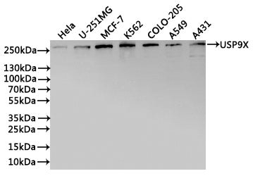 Western Blot
Positive WB detected in: Hela whole cell lysate(30µg), U-251MG whole cell lysate(30µg), MCF-7 whole cell lysate(30µg), K562 whole cell lysate(30µg), COLO-205 whole cell lysate(30µg), A549 whole cell lysate(30µg), A431 whole cell lysate(30µg)
All lanes: USP9X antibody at 1:1000
Secondary
Goat polyclonal to rabbit IgG at 1/40000 dilution
Predicted band size: 290 kDa
Observed band size: 292 kDa
Exposure time：30s
