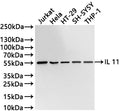 Western Blot
Positive WB detected in: Jurkat whole cell lysate(30µg) , Hela whole cell lysate(30µg) , HT-29 whole cell lysate(30µg) , SH-SY5Y whole cell lysate(30µg) , THP-1 whole cell lysate(30µg) 
All lanes: IL 11 antibody at 1:1000
Secondary
Goat polyclonal to rabbit IgG at 1/40000 dilution
Predicted band size: 45 kDa
Observed band size: 55 kDa
Exposure time：20s