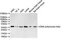 Western Blot
Positive WB detected in: K562 whole cell lysate(30µg) , PC-3 whole cell lysate(30µg) , Hela whole cell lysate(30µg) , Jurkat whole cell lysate(30µg) , Mouse brain tissue lysate(30µg) , Rat brain tissue lysate(30µg) 
All lanes: DNA polymerase beta antibody at 1:1000
Secondary
Goat polyclonal to rabbit IgG at 1/40000 dilution
Predicted band size: 38 kDa
Observed band size: 38 kDa
Exposure time：3min