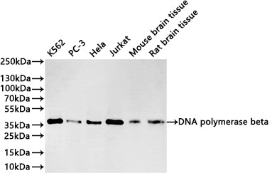 Western Blot
Positive WB detected in: K562 whole cell lysate(30µg) , PC-3 whole cell lysate(30µg) , Hela whole cell lysate(30µg) , Jurkat whole cell lysate(30µg) , Mouse brain tissue lysate(30µg) , Rat brain tissue lysate(30µg) 
All lanes: DNA polymerase beta antibody at 1:1000
Secondary
Goat polyclonal to rabbit IgG at 1/40000 dilution
Predicted band size: 38 kDa
Observed band size: 38 kDa
Exposure time：3min