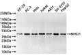 Western Blot
Positive WB detected in: HT-29 whole cell lysate(30µg) , PC-3 whole cell lysate(30µg) , Hela whole cell lysate(30µg) , Jurkat whole cell lysate(30µg) , A431 whole cell lysate(30µg) , SH-SY5Y whole cell lysate(30µg) , HepG2 whole cell lysate(30µg) 
All lanes:NHEJ1 antibody at 1:1000
Secondary
Goat polyclonal to rabbit IgG at 1/40000 dilution
Predicted band size: 33 kDa
Observed band size: 39 kDa
Exposure time：20s