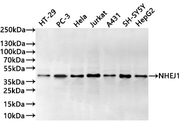 Western Blot
Positive WB detected in: HT-29 whole cell lysate(30µg) , PC-3 whole cell lysate(30µg) , Hela whole cell lysate(30µg) , Jurkat whole cell lysate(30µg) , A431 whole cell lysate(30µg) , SH-SY5Y whole cell lysate(30µg) , HepG2 whole cell lysate(30µg) 
All lanes:NHEJ1 antibody at 1:1000
Secondary
Goat polyclonal to rabbit IgG at 1/40000 dilution
Predicted band size: 33 kDa
Observed band size: 39 kDa
Exposure time：20s