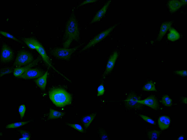 Immunofluorescence staining of PC-3 cell with CSB-RA187464A0HU at 1:50, counter-stained with DAPI. The cells were fixed in 4% formaldehyde, permeabilized using 0.2% Triton X-100 and blocked in 10% normal Goat Serum. The cells were then incubated with the antibody overnight at 4°C. The secondary antibody was Alexa Fluor 488-congugated AffiniPure Goat Anti-Rabbit IgG(H+L) .