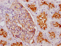 IHC image of CSB-RA187479A0HU diluted at 1:100 and staining in paraffin-embedded human kidney tissue performed on a Leica BondTM system. After dewaxing and hydration, antigen retrieval was mediated by high pressure in a citrate buffer (pH 6.0) . Section was blocked with 10% normal goat serum 30min at RT. Then primary antibody (1% BSA) was incubated at 4℃ overnight. The primary is detected by a Goat anti-rabbit IgG polymer labeled by HRP and visualized using 0.05% DAB.