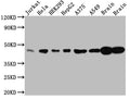 Western Blot
Positive WB detected in: Jurkat whole cell lysate, Hela whole cell lysate, HEK293 whole cell lysate, HepG2 whole cell lysate, A375 whole cell lysate, A549 whole cell lysate, Rat Brain whole cell lysate, Mouse Brain whole cell lysate
All lanes: ERK2 antibody at 1:1000
Secondary
Goat polyclonal to rabbit IgG at 1/50000 dilution
Predicted band size: 42, 37 kDa
Observed band size: 42 kDa