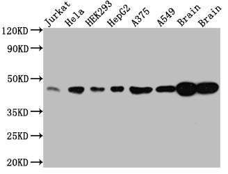 Western Blot
Positive WB detected in: Jurkat whole cell lysate, Hela whole cell lysate, HEK293 whole cell lysate, HepG2 whole cell lysate, A375 whole cell lysate, A549 whole cell lysate, Rat Brain whole cell lysate, Mouse Brain whole cell lysate
All lanes: ERK2 antibody at 1:1000
Secondary
Goat polyclonal to rabbit IgG at 1/50000 dilution
Predicted band size: 42, 37 kDa
Observed band size: 42 kDa