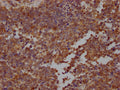 STAT3 Antibody – Figure 1 of 1