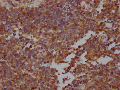 STAT3 Antibody – Figure 1 of 1